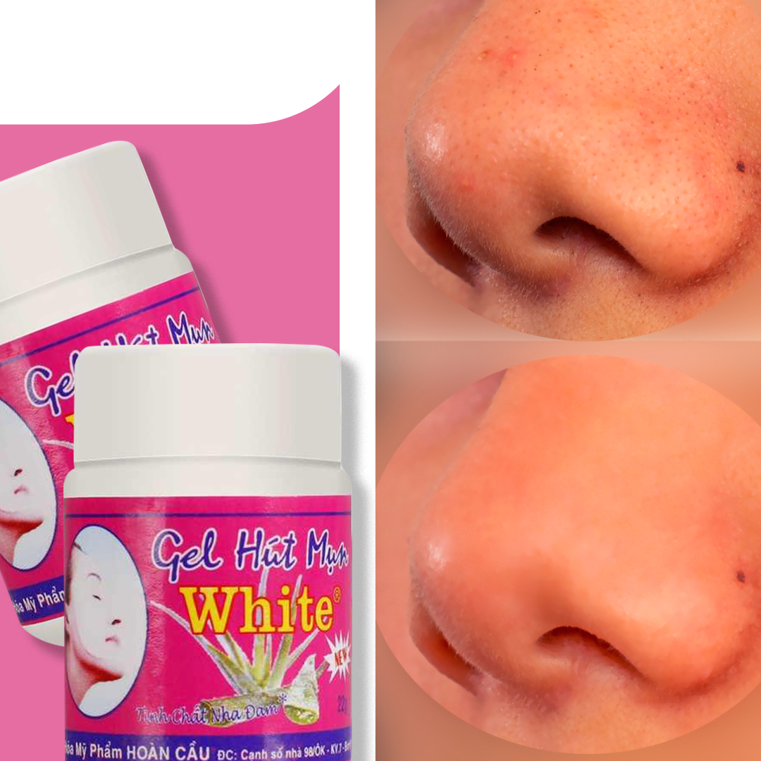 Blackhead gel Blackhead gel Beauty tools Blackhead gel Blackhead gel Beauty tools