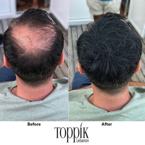 مجموعة العناية بالشعر-Toppik Hair Fibers لفراغات الشعر+Enliven لتثبيت الشعر مجموعة العناية بالشعر-Toppik Hair Fibers لفراغات الشعر+Enliven لتثبيت الشعر Cosmetics