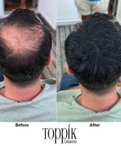 Toppik Hair Fibers